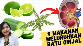 Bukan Obat! Ini 9 Zat Alami Ampuh yang Terbukti Mampu Meluruhkan Batu Ginjal
