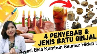 Waspada Pemicunya! Kenali 4 Jenis Batu Ginjal dan Apa yang Harus Dihindari