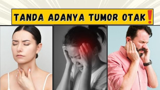 Gejala Tumor Otak Ini Sering Diabaikan, Kenali Tanda Peringatannya Sekarang