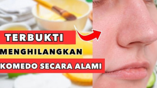 Hempas Komedo Secara Alami, Ini 10 Cara Mudah untuk Kesehatan Kulit Kamu!