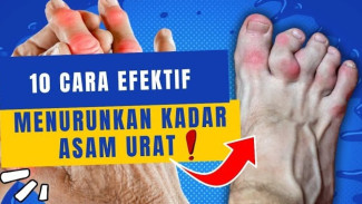 Menurunkan Asam Urat Secara Alami, Cukup Pakai 10 Cara Efektif Tanpa Obat