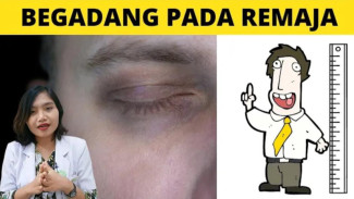 Bukan Cuma Ngantuk! 9 Dampak Mengerikan Kurang Tidur: Dari Gagal Tinggi hingga Halusinasi!