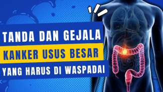 Waspadai Gejala Kanker Usus Besar, 9 Tanda Ini Harus Anda Ketahui Sebelum Terlambat