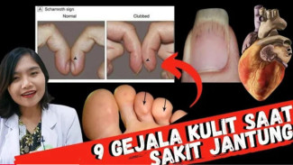 Jangan Abaikan! 9 Tanda Kulit Ini Ternyata Sinyal Jantung Mau Jebol!