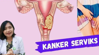 Wanita Wajib Tau! 9 Kebiasaan Sepele Ini Diam-Diam Jadi Pintu Masuk Kanker Serviks