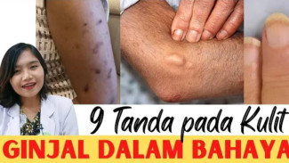 Hati-Hati! Ini 9 Tanda Bahaya Di Kulit Yang Menunjukkan Ginjal Sedang Bermasalah!