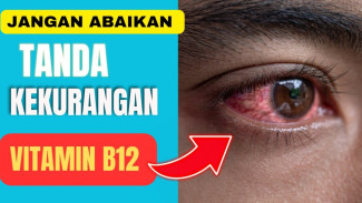 5 Gejala Kekurangan Vitamin B12 Paling Berbahaya, Segera Cek Sebelum Makin Parah