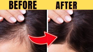 10 Tips Menumbuhkan Rambut Secara Alami, Terbukti Ampuh dan Super Cepat