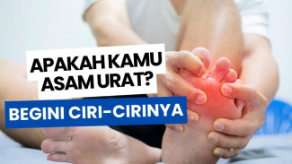 Asam Urat Sering Menyerang Ibu Jari Kaki, Ini Ciri Fisik Penumpukan Kristal yang Berbahaya