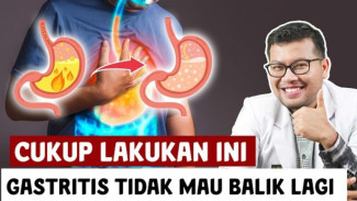 Waspada! 10 Cara Ampuh Mencegah Gastritis (Radang Lambung) Kambuh: Atur Tidur Hingga Makanan Pemicu
