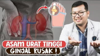 Stop Fokus Nyeri Sendi Saja! Waspada Asam Urat Rusak Ginjal Kalau Angka Sudah Ketinggian!