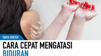 Biduran Sebabkan Gatal dan Bentol Kemerahan, Ini Cara Cepat Mengatasinya di Rumah
