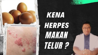 Mitos Vs Fakta Telur dan Herpes: Bikin Herpes Parah atau Malah Jadi Booster Imun Fantastis