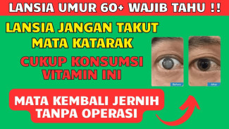 Mata Kabur Karena Katarak Bisa Jernih Lagi Tanpa Operasi Mahal Cukup Konsumsi Vitamin Murah Ini