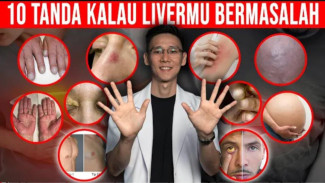 10 Tanda Kulit Saat Liver Bermasalah: Jaga Aliran Energi Lancar untuk Detoksifikasi Tubuh!