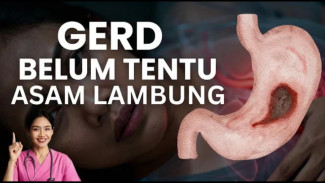 Saraf Tenang! Trik Atasi Penyakit Lambung Agar Gejala GERD Membaik