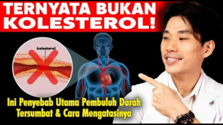 Pembuluh Darah Plong! Rahasia Trik Jitu Bersihkan Penyumbatan Alami Tanpa Obat Kimia