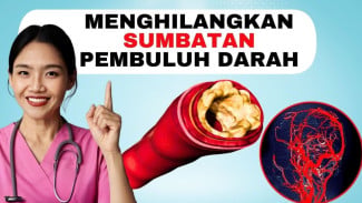 Rahasia Mengecilkan Plak Pembuluh Darah Tanpa Operasi, Cukup 4 Cara Ilmiah Ini Bikin Jantung Lebih Sehat