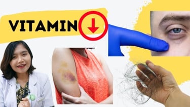 Gejala kekurangan vitamin