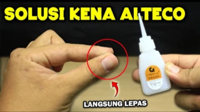 Lem Besi Nempel di Tangan