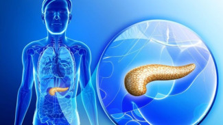 Wamenkes Tawarkan Pankreas Buatan untuk Atasi Diabetes, Begini Tanggapan Dokter