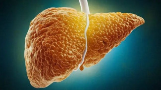 Tubuh Tampak Sehat Tapi Hati Rusak! Ini Ciri-Ciri Fatty Liver yang Perlu Kamu Tahu