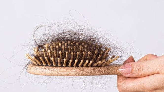 Rambut Rontok