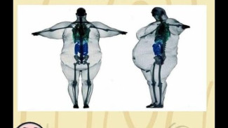 Punya Tulang Besar Susah Kurus? Mitos atau Fakta?
