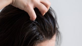 Polusi Udara dan Dampaknya pada Kulit serta Rambut