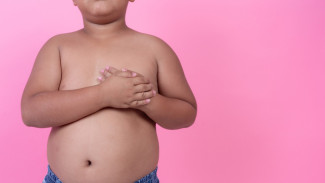 Dokter Ungkap Bahaya Obesitas pada Anak dan Cara Efektif Mencegahnya