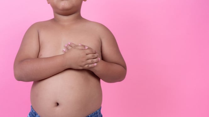 Ilustrasi obesitas pada anak