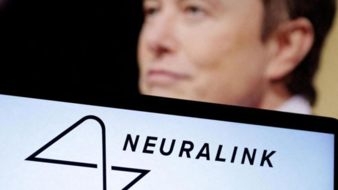 Neuralink