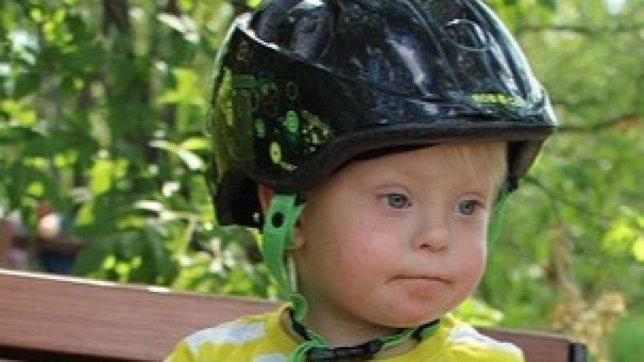 Anak Penderita Down Syndrome