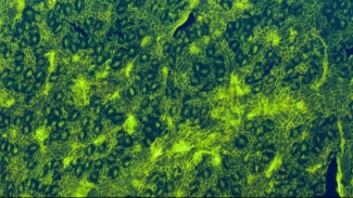 Fosil Pertama Pohon Tropis Hidup yang Terancam Punah Ditemukan di Hutan Kalimantan