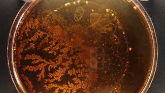 Peneliti Ungkap Strain E. Coli Menyebar Secepat Flu Babi