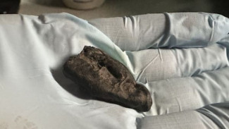 DNA Kuno Mengungkapkan Seorang Gadis Remaja Mengunyah Gumpalan Permen Karet 10.500 Tahun yang Lalu