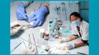 Inovasi Terbaru Perawatan Karies Gigi: Teknologi Baru untuk Menjaga Vitalitas Gigi Permanen