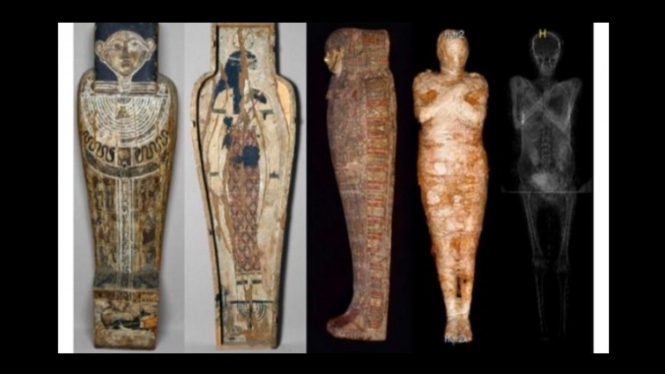 Sarkofagus dan Pemindaian Mumi Wanita Hamil