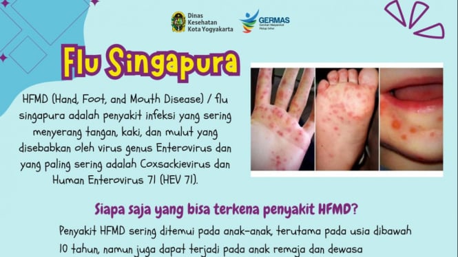 Waspada Penyakit Flu Singapura Berjangkit di Yogyakarta