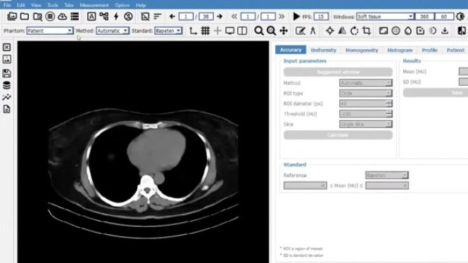 Menepis Takut CT Scan: Rahasia Optimisasi Radiasi Lewat Inovasi Perangkat Lunak Anak Bangsa yang Mendunia