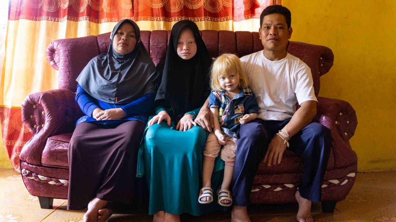 Keberagaman Dalam Keakraban Keluarga Albino
