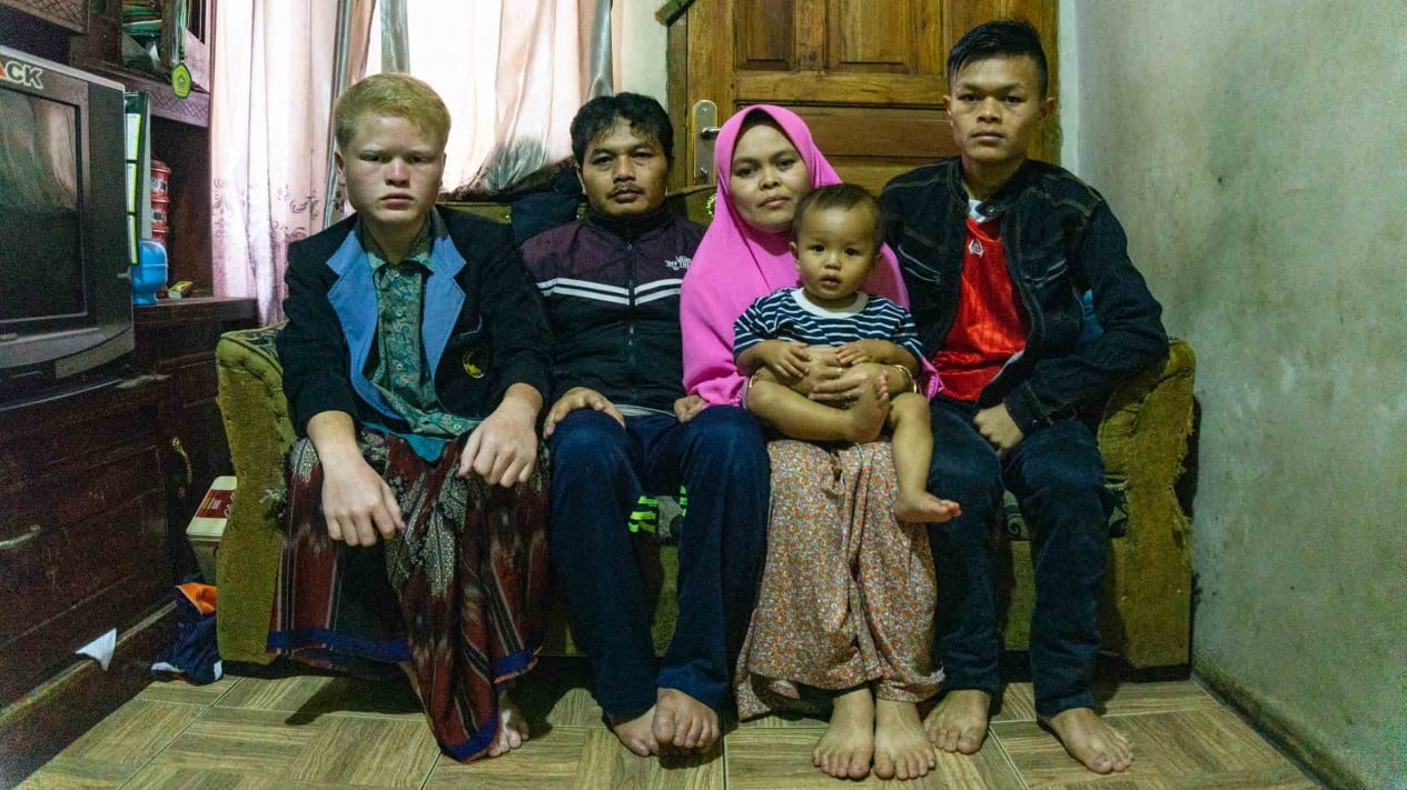 Keberagaman Dalam Keakraban Keluarga Albino