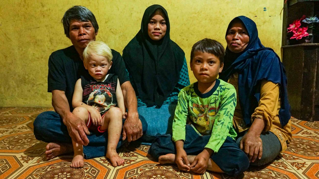 Keberagaman Dalam Keakraban Keluarga Albino