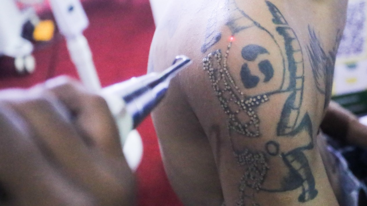Hapus Tato Gratis di Bulan Ramadhan