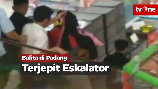 Balita di Padang Terjepit Eskalator, Saraf Tangan Hancur