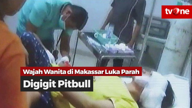 Lagi, Wanita Luka Parah di Wajah Diserang Pitbull