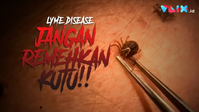 JANGAN REMEHKAN KUTU! Penyakit Lyme Disease Mengancam!
