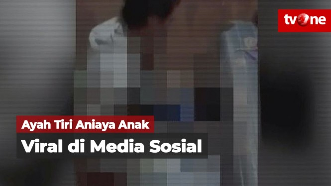 Ayah Tiri Aniaya Anak Viral di Media Sosial