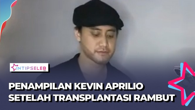 Penampilan Kevin Aprilio Setelah Transplantasi Rambut