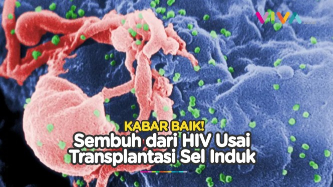 Pasien HIV Sembuh usai Transplantasi Sel Induk